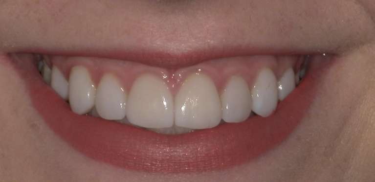 Cosmetic-After-Image