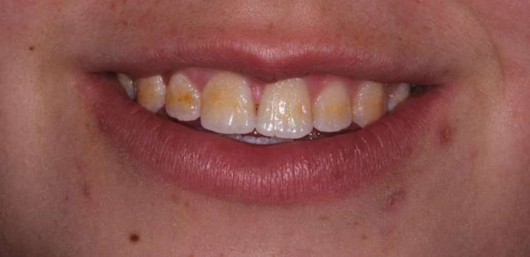 Cosmetic-Before-Image